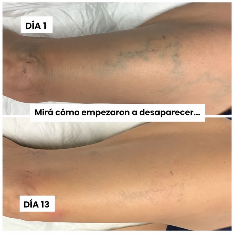 Día 1 y día 13: mirá cómo empezaron a desaparecer